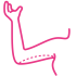 brachioplasty